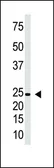 Anti-IL29 antibody used in Western Blot (WB). GTX04572