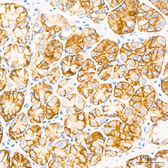 Anti-Claudin 18.2 antibody [ARC5062-02] used in IHC (Paraffin sections) (IHC-P). GTX04575