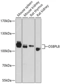 Anti-ORP8 antibody used in Western Blot (WB). GTX04576
