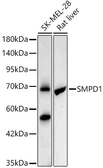Anti-ASM antibody [ARC62108] used in Western Blot (WB). GTX04580