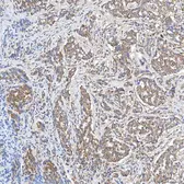 Anti-SLC20A1 antibody used in IHC (Paraffin sections) (IHC-P). GTX04583