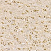 Anti-PPP2R5D antibody [ARC2981] used in IHC (Paraffin sections) (IHC-P). GTX04590