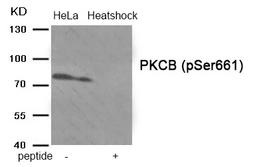 Anti-PKC beta 1 (phospho Ser661) antibody used in Western Blot (WB). GTX04594