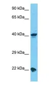 Anti-LIPT1 antibody used in Western Blot (WB). GTX04597