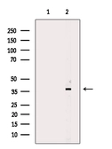 Anti-CEACAM6 antibody used in Western Blot (WB). GTX04599