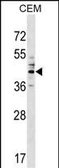 Anti-CEACAM6 antibody used in Western Blot (WB). GTX04600