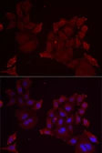 Anti-Pannexin 1 antibody used in Immunocytochemistry/ Immunofluorescence (ICC/IF). GTX04618