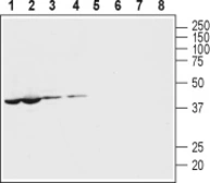 Anti-Pannexin 1 antibody used in Western Blot (WB). GTX04619