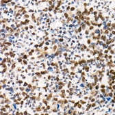 Anti-SNF5 antibody [ARC53139] used in IHC (Paraffin sections) (IHC-P). GTX04623