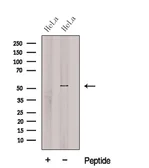 Anti-C6ORF150 antibody used in Western Blot (WB). GTX04624