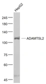 Anti-ADAMTSL2 antibody used in Western Blot (WB). GTX04625