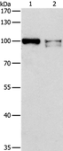 Anti-ADAMTSL2 antibody used in Western Blot (WB). GTX04626