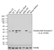 Anti-SSTR5 antibody used in Western Blot (WB). GTX04631