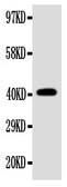 Anti-EDA antibody used in Western Blot (WB). GTX04635