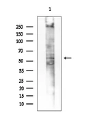 Anti-EDAR antibody used in Western Blot (WB). GTX04637