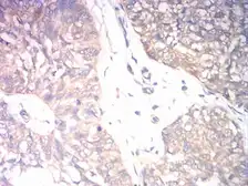 Anti-IL3 Receptor beta antibody [1D5E4] used in IHC (Paraffin sections) (IHC-P). GTX04642