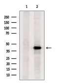 Anti-SCD antibody used in Western Blot (WB). GTX04643