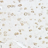 Anti-SCD antibody used in IHC (Paraffin sections) (IHC-P). GTX04645