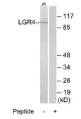 Anti-LGR4 antibody used in Western Blot (WB). GTX04647