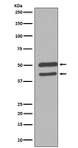 Anti-JNK antibody [DFI-13] used in Western Blot (WB). GTX04659