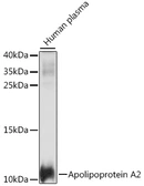 Anti-Apolipoprotein A2 antibody used in Western Blot (WB). GTX04661