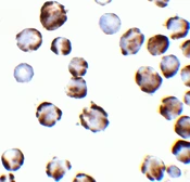 Anti-TRPC6 antibody used in IHC-P (cell pellet) (IHC-P (cell pellet)). GTX04669