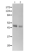 Anti-Horseradish Peroxidase antibody used in Western Blot (WB). GTX04689