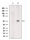 Anti-Gasdermin D antibody used in Western Blot (WB). GTX04690