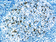 Anti-CD57 antibody [NK-1] used in IHC (Paraffin sections) (IHC-P). GTX04711