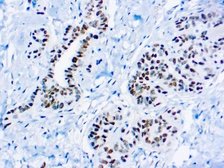 Anti-Wilms Tumor 1 antibody [6F-H2] used in IHC (Paraffin sections) (IHC-P). GTX04715