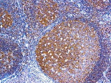 Anti-BCL10 antibody [151] used in IHC (Paraffin sections) (IHC-P). GTX04716