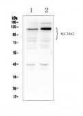 Anti-SLC34A2 antibody used in Western Blot (WB). GTX04719