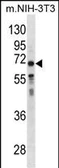Anti-GGT1 antibody used in Western Blot (WB). GTX04721
