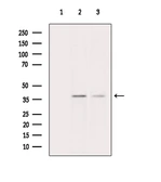 Anti-CD66b antibody used in Western Blot (WB). GTX04722