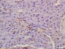 Anti-EDA antibody used in IHC (Paraffin sections) (IHC-P). GTX04731