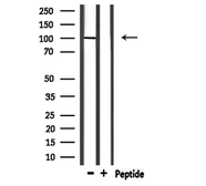 Anti-TLR2 antibody used in Western Blot (WB). GTX04732