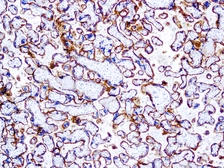 Anti-EGFR antibody [31G7] used in IHC (Paraffin sections) (IHC-P). GTX04735
