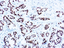 Anti-Estrogen Receptor antibody [SP1] used in IHC (Paraffin sections) (IHC-P). GTX04736