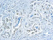 Anti-Cyclin D1 antibody [SP4] used in IHC (Paraffin sections) (IHC-P). GTX04738