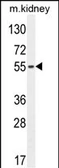 Anti-FBXO39 antibody, C-term used in Western Blot (WB). GTX04746