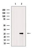 Anti-Hemoglobin alpha antibody used in Western Blot (WB). GTX04751