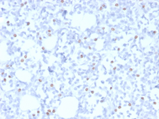 Anti-Estrogen Receptor beta 5 antibody [PPG5/25] used in IHC (Paraffin sections) (IHC-P). GTX04767