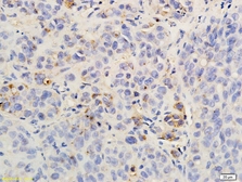 Anti-CXCR2 antibody used in IHC (Paraffin sections) (IHC-P). GTX04768