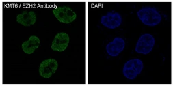 Anti-EZH2 antibody [IDF-5] used in Immunocytochemistry/ Immunofluorescence (ICC/IF). GTX04778
