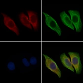 Anti-Syndecan 4 antibody used in Immunocytochemistry/ Immunofluorescence (ICC/IF). GTX04783