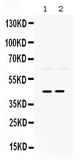 Anti-PAX2 antibody used in Western Blot (WB). GTX04784
