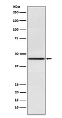 Anti-PAX2 antibody [BDA-16] used in Western Blot (WB). GTX04785