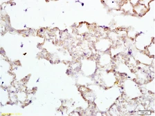 Anti-PAX2 antibody used in IHC (Paraffin sections) (IHC-P). GTX04786