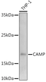 Anti-Cathelicidin antibody used in Western Blot (WB). GTX04791