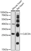 Anti-CLEC5A antibody used in Western Blot (WB). GTX04797